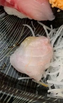 吃日料感染寄生虫的症状